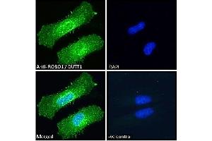 (ABIN185537) Immunofluorescence analysis of paraformaldehyde fixed HeLa cells, permeabilized with 0.