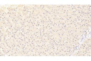 Detection of FN3K in Human Liver Tissue using Polyclonal Antibody to Fructosamine-3-Kinase (FN3K)