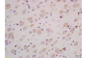 Formalin-fixed and paraffin embedded rat brain labeled with Rabbit Anti-INPPL1 Polyclonal Antibody, Unconjugated (ABIN722200) at 1:200 followed by conjugation to the secondary antibody and DAB staining (INPPL1 anticorps  (AA 701-800))