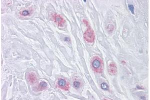 Human Placenta: Formalin-Fixed, Paraffin-Embedded (FFPE) (BUB1B anticorps  (AA 1-130))