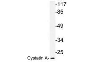 Western blot analysis of Cystatin A antibody in extracts from HT-29 cells. (CSTA anticorps)
