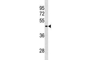 RBMY1A1 antibody western blot analysis in NCI-H292 lysate.