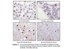 Image no. 1 for anti-K(lysine) Acetyltransferase 5 (KAT5) antibody (ABIN232140) (KAT5 anticorps)