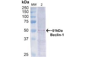 Western blot analysis of Human Cervical cancer cell line (HeLa) lysate showing detection of ~51 kDa Beclin 1 protein using Rabbit Anti-Beclin 1 Polyclonal Antibody (ABIN2868739). (Beclin 1 anticorps)