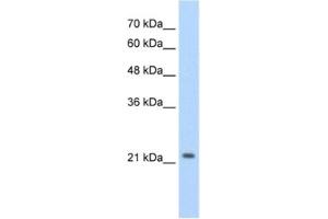 Western Blotting (WB) image for anti-Distal-Less Homeobox Protein 2 (DLX2) antibody (ABIN2460395)