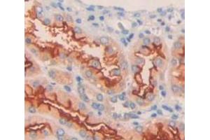 Used in DAB staining on fromalin fixed paraffin- embedded Kidney tissue (KCNJ10 anticorps  (AA 165-379))