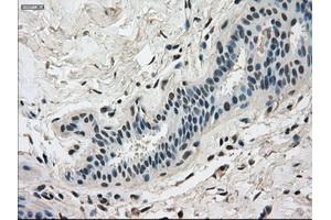 Immunohistochemical staining of paraffin-embedded breast tissue using anti-DHFR mouse monoclonal antibody. (Dihydrofolate Reductase anticorps)