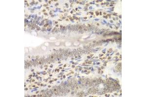 Immunohistochemistry of paraffin-embedded rat Intestine using UHRF2 antibody (ABIN6133264, ABIN6149911, ABIN6149913 and ABIN6217665) at dilution of 1:200 (40x lens).