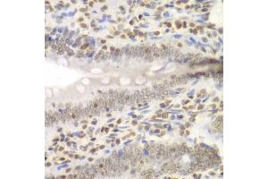 Immunohistochemistry of paraffin-embedded rat Intestine using UHRF2 antibody (ABIN6133264, ABIN6149911, ABIN6149913 and ABIN6217665) at dilution of 1:200 (40x lens). (UHRF2 anticorps  (AA 441-622))