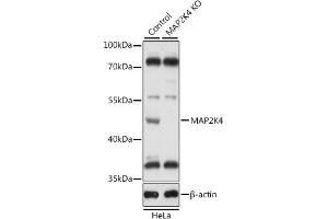 Western blot analysis of extracts from normal (control) and MK4 knockout (KO) HeLa cells, using MK4 antibody (ABIN7268641) at 1:1000 dilution.