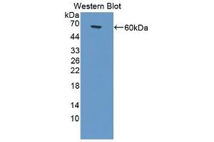 Detection of Recombinant G6PD, Human using Polyclonal Antibody to Glucose-6-phosphate Dehydrogenase (G6PD) (Glucose-6-Phosphate Dehydrogenase anticorps)