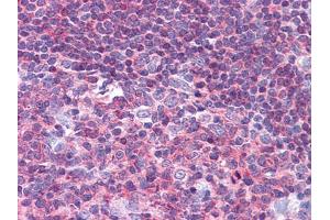 Immunohistochemical analysis of paraffin-embedded human Tonsil tissues using PYK2 mouse mAb.