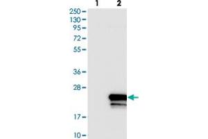 Western blot analysis of Lane 1: Negative control (vector only transfected HEK293T lysate). (SLC51B anticorps)