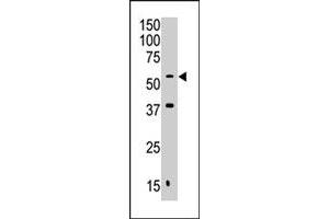 The MAFK polyclonal antibody  is used in Western blot to detect MAFK in Jurkat cell lysate.
