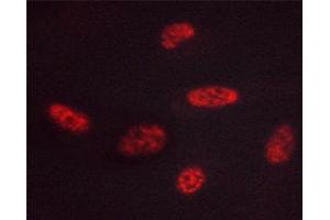 ABIN6267444 staining HUVEC cells by ICC/IF. (GATA3 anticorps  (pSer308))