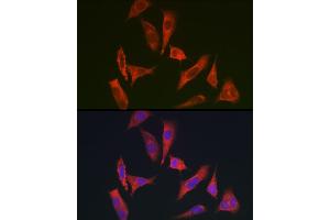 Immunofluorescence analysis of HeLa cells using MYO10 antibody (ABIN6128319, ABIN6144271, ABIN6144274 and ABIN6216113) at dilution of 1:350. (Myosin X anticorps  (AA 845-944))