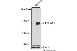 Western blot analysis of extracts of NIH/3T3 cells, using Phospho-Lyn-Y396 Rabbit mAb (ABIN7271269) at 1:1000 dilution. (LYN anticorps  (pTyr396))