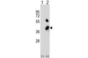 Western blot analysis of BCKDHB (arrow) using rabbit polyclonal BCKDHB Antibody (N-term) .