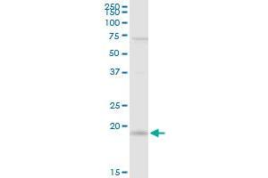 IL21 MaxPab rabbit polyclonal antibody. (IL-21 anticorps  (AA 1-162))