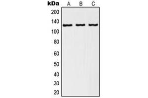 Western blot analysis of RANBP6 expression in A549 (A), K562 (B), human kidney (C) whole cell lysates. (RANBP6 anticorps  (Center))