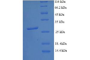 SDS-PAGE (SDS) image for DNA (Cytosine-5-)-Methyltransferase 3 alpha (DNMT3A) (AA 680-902), (partial) protein (His tag) (ABIN5712013) (DNMT3A Protein (AA 680-902, partial) (His tag))