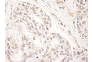 anti-Mediator Complex Subunit 1 (MED1) (AA 1531-1581) antibody
