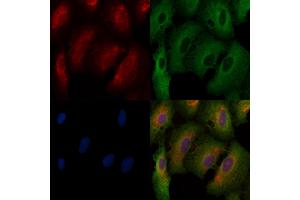 ABIN6261136 and ABIN6272575 staining  cells by IF/ICC. (CYBA anticorps  (N-Term))