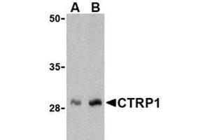 Western blot analysis of CTRP1 in human kidney cell lysate with AP30247PU-N CTRP1 antibody at (A) 1 and (B) 2 μg/ml. (C1QTNF1 anticorps  (N-Term))
