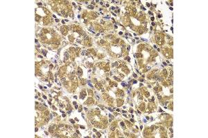 Immunohistochemistry of paraffin-embedded human gastric using HSPE1 antibody.