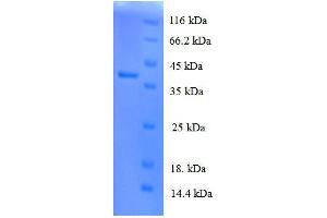 Protein expressed in E.