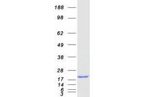 Validation with Western Blot