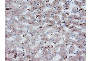 Image no. 8 for anti-Carboxypeptidase A2 (Pancreatic) (CPA2) antibody (ABIN1497596)