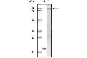 Western blot analysis using TYK2 mouse mAb against truncated TYK2 recombinant protein (1) and Jurkat cell lysate(2).