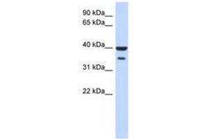 Image no. 1 for anti-Zinc Finger Protein 785 (ZNF785) (N-Term) antibody (ABIN6742921) (ZNF785 anticorps  (N-Term))