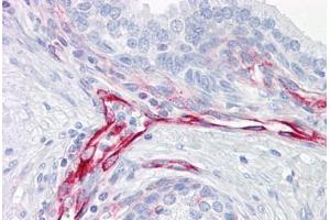 Anti-Vimentin antibody IHC staining of human prostate. (Vimentin anticorps)
