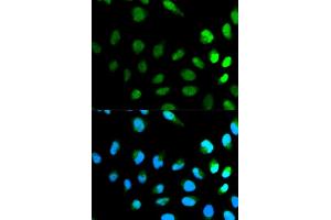 Immunofluorescence analysis of HeLa cell using NEDD8 antibody. (NEDD8 anticorps)