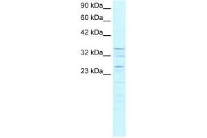 WB Suggested Anti-ZNF385 Antibody Titration: 0. (ZNF385A anticorps  (C-Term))