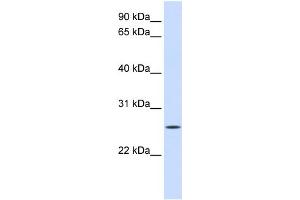 WB Suggested Anti-UNC50 Antibody Titration:  0. (UNC50 anticorps  (N-Term))