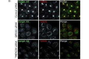 GPR161 and TMEM220, two novel Golgi-resident proteins involved in protein secretion, regulate glycoprotein secretion by different mechanisms.