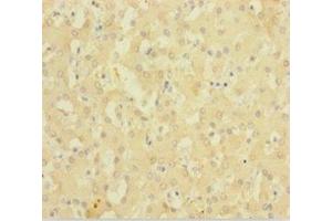 Immunohistochemistry of paraffin-embedded human liver tissue using ABIN7143220 at dilution of 1:100