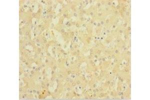 Immunohistochemistry of paraffin-embedded human liver tissue using ABIN7143220 at dilution of 1:100 (Diazepam Binding Inhibitor anticorps  (AA 2-105))