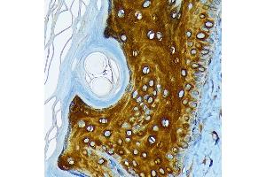 Immunohistochemistry of paraffin-embedded rat skin using Cytokeratin 1 (KRT1) (KRT1) Rabbit mAb (ABIN7268085) at dilution of 1:100 (40x lens). (Cytokeratin 1 anticorps)