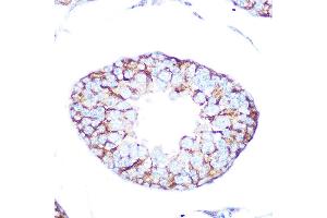 Immunohistochemistry of paraffin-embedded rat testis using Muscarinic AChR M2 (Muscarinic AChR M2 ) Rabbit mAb (ABIN7266346) at dilution of 1:100 (40x lens).