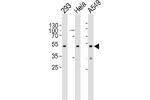 Western blot analysis of lysates from 293, Hela, A549 cell line (from left to right), using CBX8 Antibody (C-term) (ABIN6242216 and ABIN6577075). (CBX8 anticorps  (C-Term))
