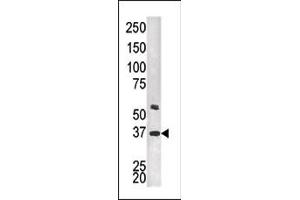 The anti-PTK9L Pab (ABIN1882143 and ABIN2841318) is used in Western blot to detect PTK9L in HEPG2 tissue lysate.