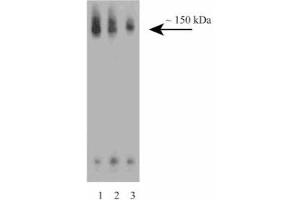 Western blot analysis of CD100 on a Jurkat cell lysate (Human T-cell leukemia, ATCC TIB-152). (SEMA4D/CD100 anticorps  (AA 721-861))