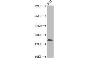 Western Blot Positive WB detected in: PC-3 whole cell lysate All lanes: HIST1H1D antibody at 1 μg/mL Secondary Goat polyclonal to rabbit IgG at 1/50000 dilution Predicted band size: 23 kDa Observed band size: 23 kDa