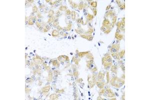 Immunohistochemistry of paraffin-embedded human stomach using DDX39A antibody (ABIN6131590, ABIN6139489, ABIN6139491 and ABIN6223963) at dilution of 1:100 (40x lens). (DDX39 anticorps  (AA 178-427))