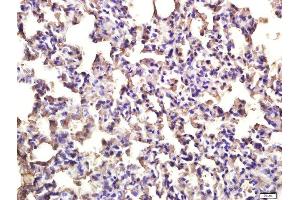 Paraformaldehyde-fixed, paraffin embedded rat lung tissue, Antigen retrieval by boiling in sodium citrate buffer(pH6) for 15min, Block endogenous peroxidase by 3% hydrogen peroxide for 30 minutes, Blocking buffer (normal goat serum) at 37°C for 20min, Antibody incubation with Rabbit Anti-TLR3 Polyclonal Antibody, Unconjugated  at 1:400 overnight at 4°C, followed by a conjugated secondary and DAB staining