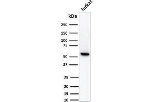 Western Blot Analysis of human Jurkat cell lysate using Topo I, MT Mouse Monoclonal Antibody (TOP1MT/488). (TOP1MT anticorps)